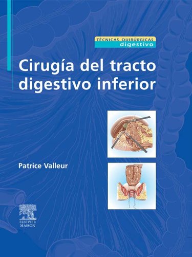 CirugÃ­a del tracto digestivo inferior (Spanish Edition)