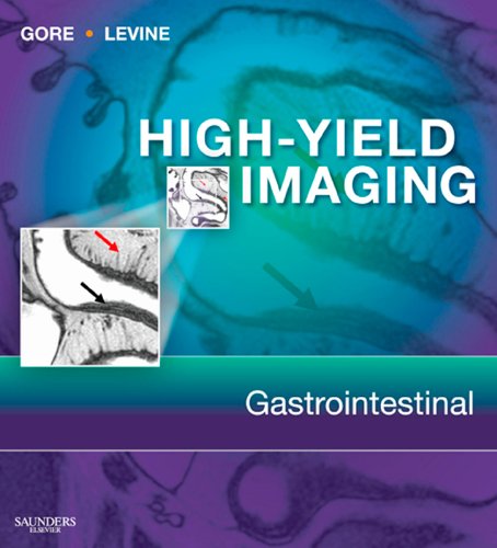 High Yield Imaging Gastrointestinal (HIGH YIELD in Radiology)