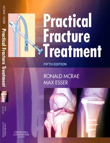 Practical Fracture Treatment