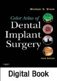 Color Atlas of Dental Implant Surgery