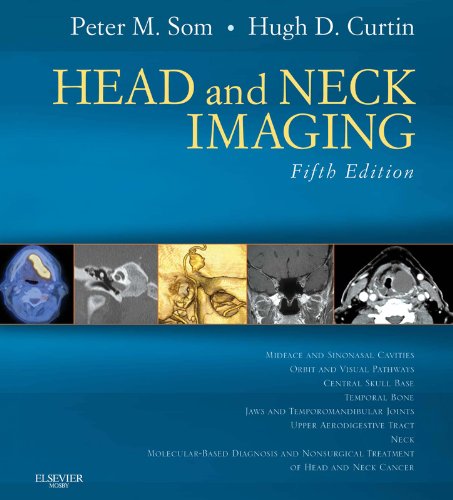 Head and Neck Imaging (Expert Consult)