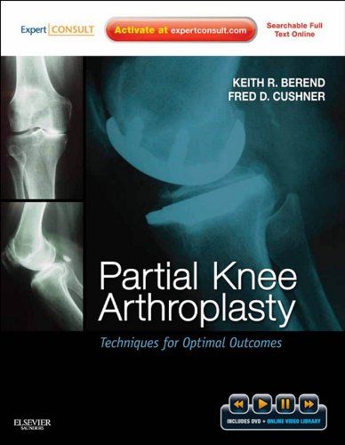 Partial Knee Arthroplasty: Techniques and Optimal Outcomes - Expert Consult