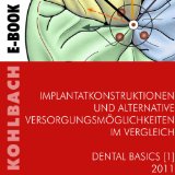 Implantatkonstruktionen und alternative VersorgungsmÃ¶glichkeiten im Vergleich (Dental Basics 1) (German Edition)