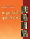 Imaging Painful Spine Disorders