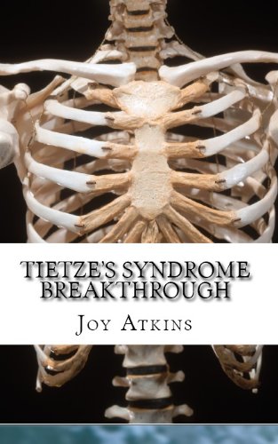Tietze's Syndrome Breakthrough
