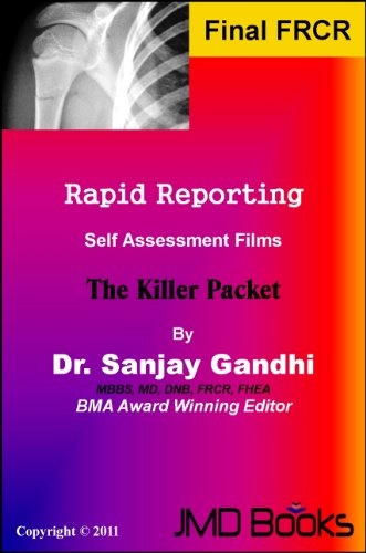 Rapid Reporting 'The Killer Packets' (Rapid Reporting Series)