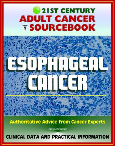 21st Century Adult Cancer Sourcebook: Esophageal Cancer (Cancer of the Esophagus) - Clinical Data for Patients, Families, and Physicians