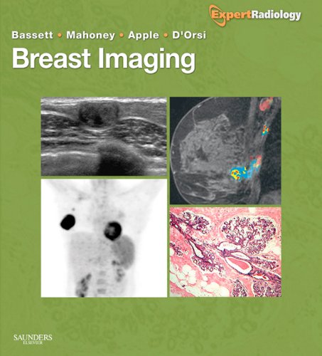 Breast Imaging Expert Radiology Series