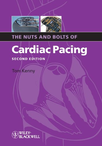 The Nuts and Bolts of Cardiac Pacing (Nuts and Bolts Series (Replaced by 5113))