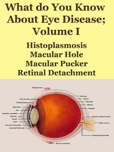 What Do You Know About Eye Disease Volume I;Histoplasmosis, Macular Hole, Macular Pucker, Retinal Detachment