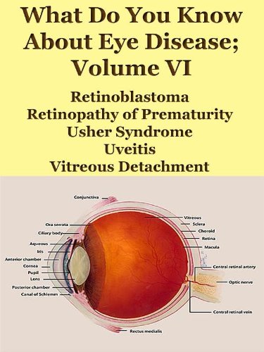 What Do You Know About Eye Disease Volume VI; Retinoblastoma, Retinopathy of Prematurity, Usher Syndrome, Uveitis, Vitreous Detachment