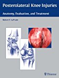Posterolateral Knee Injuries: Anatomy, Evaluation, and Treatment