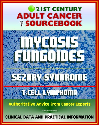 21st Century Adult Cancer Sourcebook: Mycosis Fungoides and the Sezary Syndrome, Cutaneous T-cell Lymphoma. - Clinical Data for Patients, Families, and Physicians