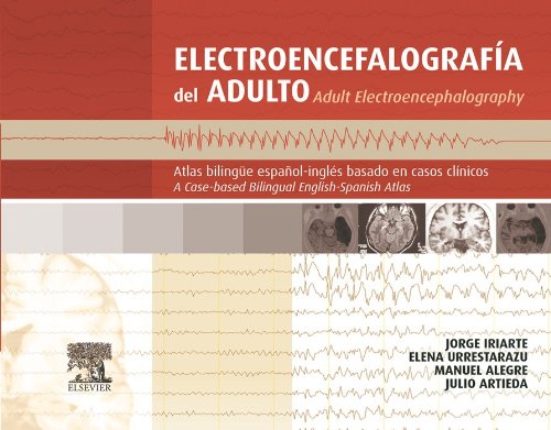 ElectroencefalografÃ­a del adulto: Atlas bilingÃ¼e espaÃ±ol-inglÃ©s basado en casos clÃ­nicos (Spanish Edition)