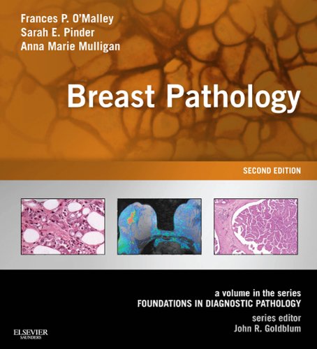 Breast Pathology: A Volume in the Series: Foundations in Diagnostic Pathology