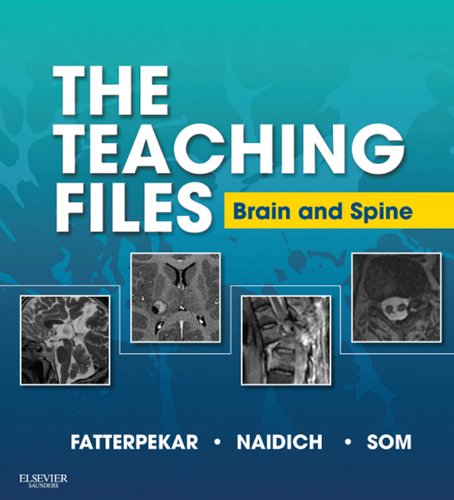 The Teaching Files: Brain and Spine Imaging