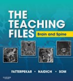 The Teaching Files: Brain and Spine Imaging
