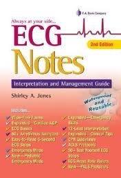 ECG Notes: Interpretation and Management Guide (Davis's Notes) 2nd (second) edition