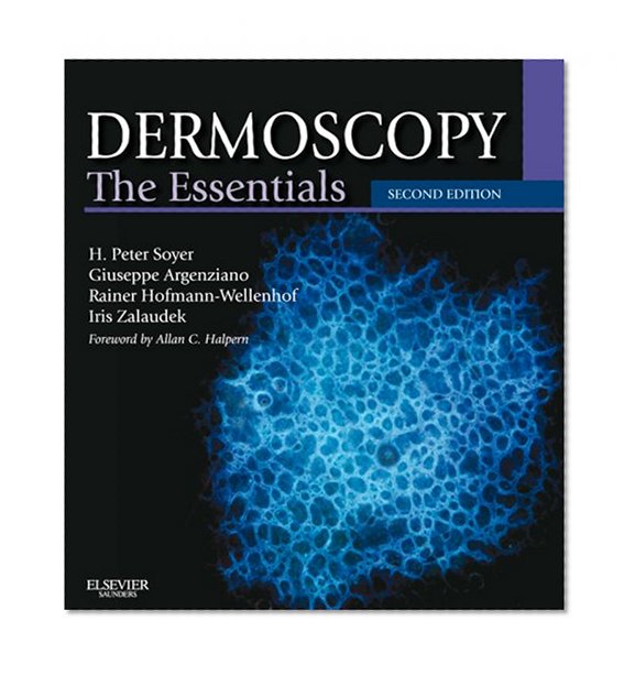 Dermoscopy: The Essentials