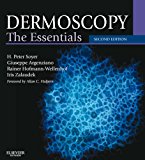 Dermoscopy: The Essentials