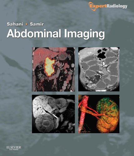 Abdominal Imaging: Expert Radiology Series