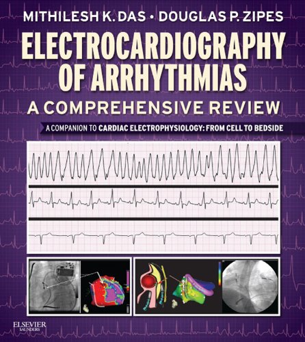 Electrocardiography of Arrhythmias: A Comprehensive Review: A Companion to Cardiac Electrophysiology
