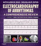 Electrocardiography of Arrhythmias: A Comprehensive Review: A Companion to Cardiac Electrophysiology
