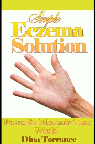 Simple Eczema Solution (Eczema Treatment Guide Book 1)