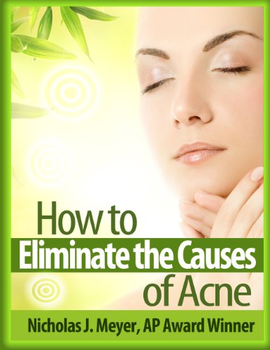 How to Eliminate the Causes of Acne