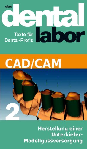 Herstellung einer Unterkiefer-Modellgussversorgung (das dental labor Fachtexte 15) (German Edition)