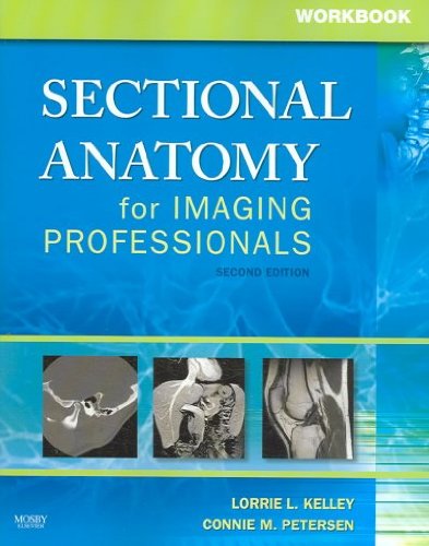 Workbook for Sectional Anatomy for Imaging Professionals (Workbook)[ WORKBOOK FOR SECTIONAL ANATOMY FOR IMAGING PROFESSIONALS (WORKBOOK) ] by Kelley, Lorrie L. (Author) Dec-01-06[ Paperback ]