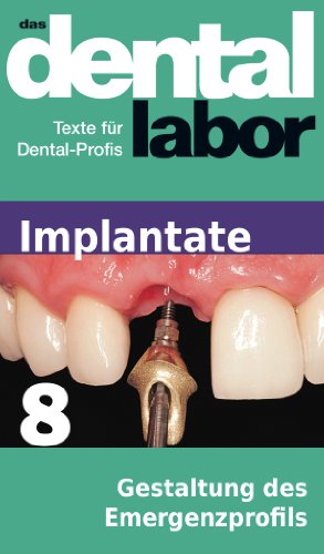 Gestaltung des Emergenzprofils (das dental labor Fachtexte 30) (German Edition)