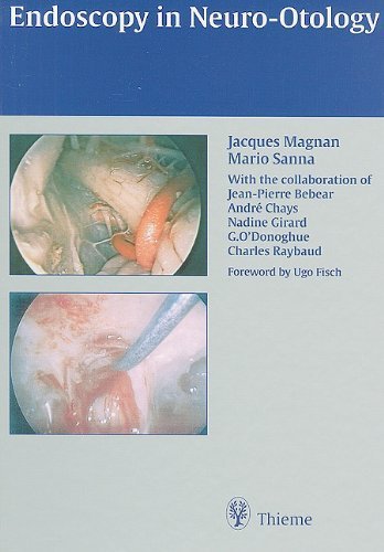 Endoscopy in Neuro-Otology 1st Edition by Magnan, Jacques; Sanna, Mario published by Thieme Hardcover