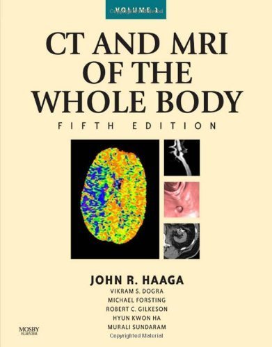 CT and MRI of the Whole Body, 2-Volume Set, 5e (Computed Tomography and Magnetic Resonance Imaging of the Wh) 5th Edition by MD, John R. Haaga; Boll, Daniel published by Mosby Hardcover