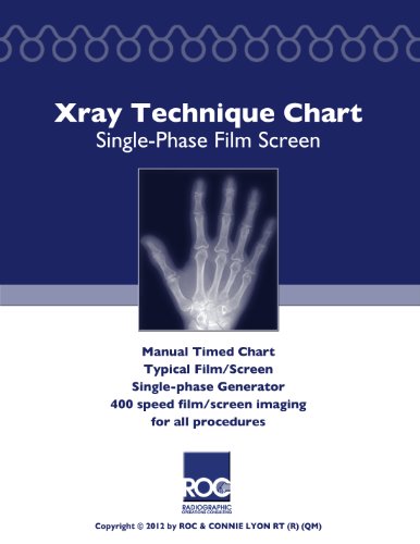 Xray Technique Chart Single-Phase Film Screen