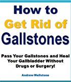 How to Get Finally Rid of Gallstones and Get Your Life Back! (Pass Your Gallstones Without Drugs or Surgery)