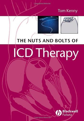 By Tom Kenny - The Nuts and Bolts of ICD Therapy