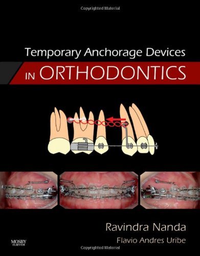 By Ravindra Nanda - Temporary Anchorage Devices in Orthodontics