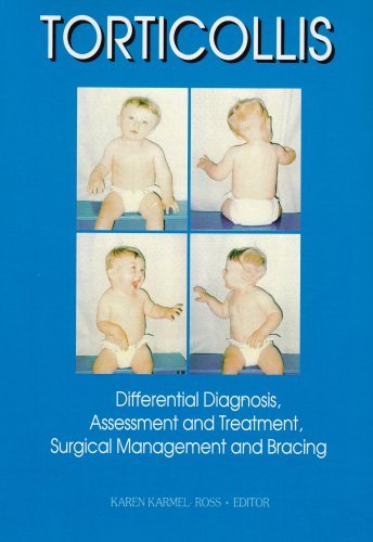 By Karen Karmel-Ross - Torticollis: Differential Diagnosis, Assessment and Treatment, Surgical Management and Bracing: 1st (first) Edition