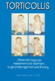 By Karen Karmel-Ross - Torticollis: Differential Diagnosis, Assessment and Treatment, Surgical Management and Bracing: 1st (first) Edition