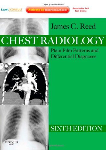 By James C. Reed - Chest Radiology: Plain Film Patterns and Differential Diagnoses, Expert Consult - Online and Print: 6th (sixth) Edition