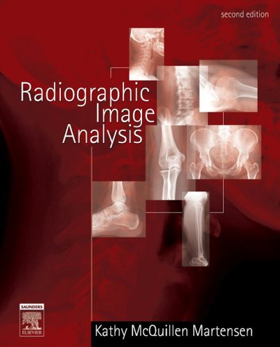 By Kathy McQuillen Martensen - Radiographic Image Analysis: 2nd (second) Edition