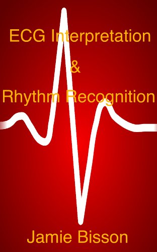 ECG Interpretation & Rhythm Recognition