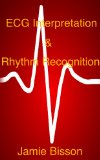 ECG Interpretation & Rhythm Recognition