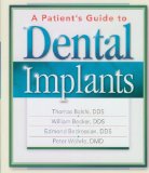 A Patient's Guide to Dental Implants