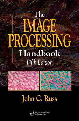The Image Processing Handbook, Fifth Edition
