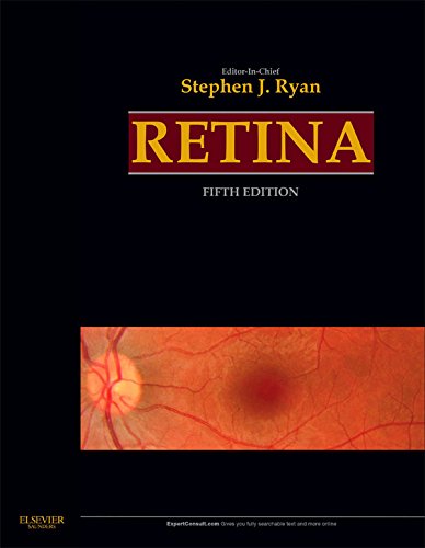 Retina E-Book (Ryan, Retina)
