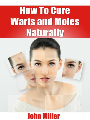 How To Cure Warts and Moles Naturally