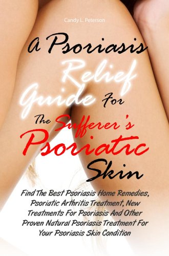A Psoriasis Relief Guide For The Sufferer's Psoriatic Skin:Find The Best Psoriasis Home Remedies, Psoriatic Arthritis Treatment, New Treatments For Psoriasis