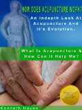 How Does Acupuncture Work? An Indepth Look At Acupuncture And It's Evolution (What Is Acupuncture & How Can It Help Me? Book 3)